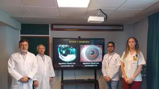 El Hospital Insular innova con una técnica para implantar iris artificiales