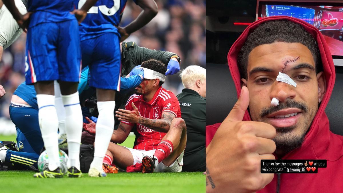 La consecuencia física del choque entre Morgan Gibbs-White y Robert Sánchez que retiró al inglés del encuentro disputado entre Chelsea y Nottingham Forest
