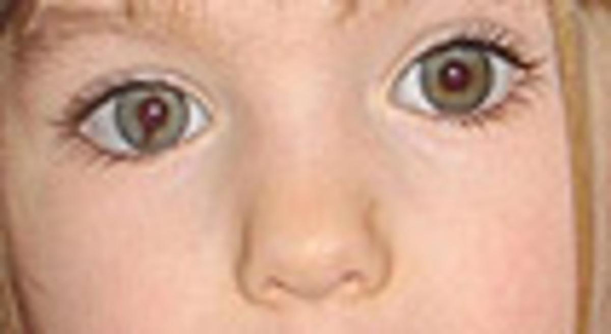 Madeleine McCann. Madeleine McCann.