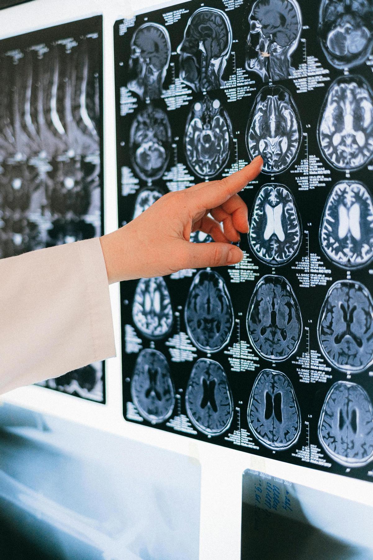 Els entorns en els quals vivim influeixen en l'edat del cervell