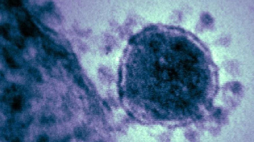 &quot;Muy bajo&quot; riesgo de coronavirus.