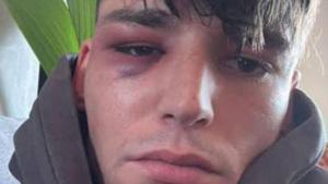 Agredit l’àrbitre que en un estadi va demanar casar-se amb  el nòvio