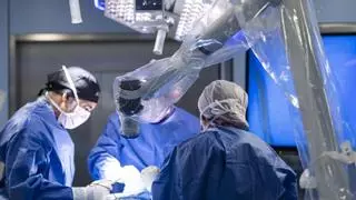Qué es un exoscopio y cómo el ORBEYE mejora la cirugía cerebral y de columna con imagen 4K 3D