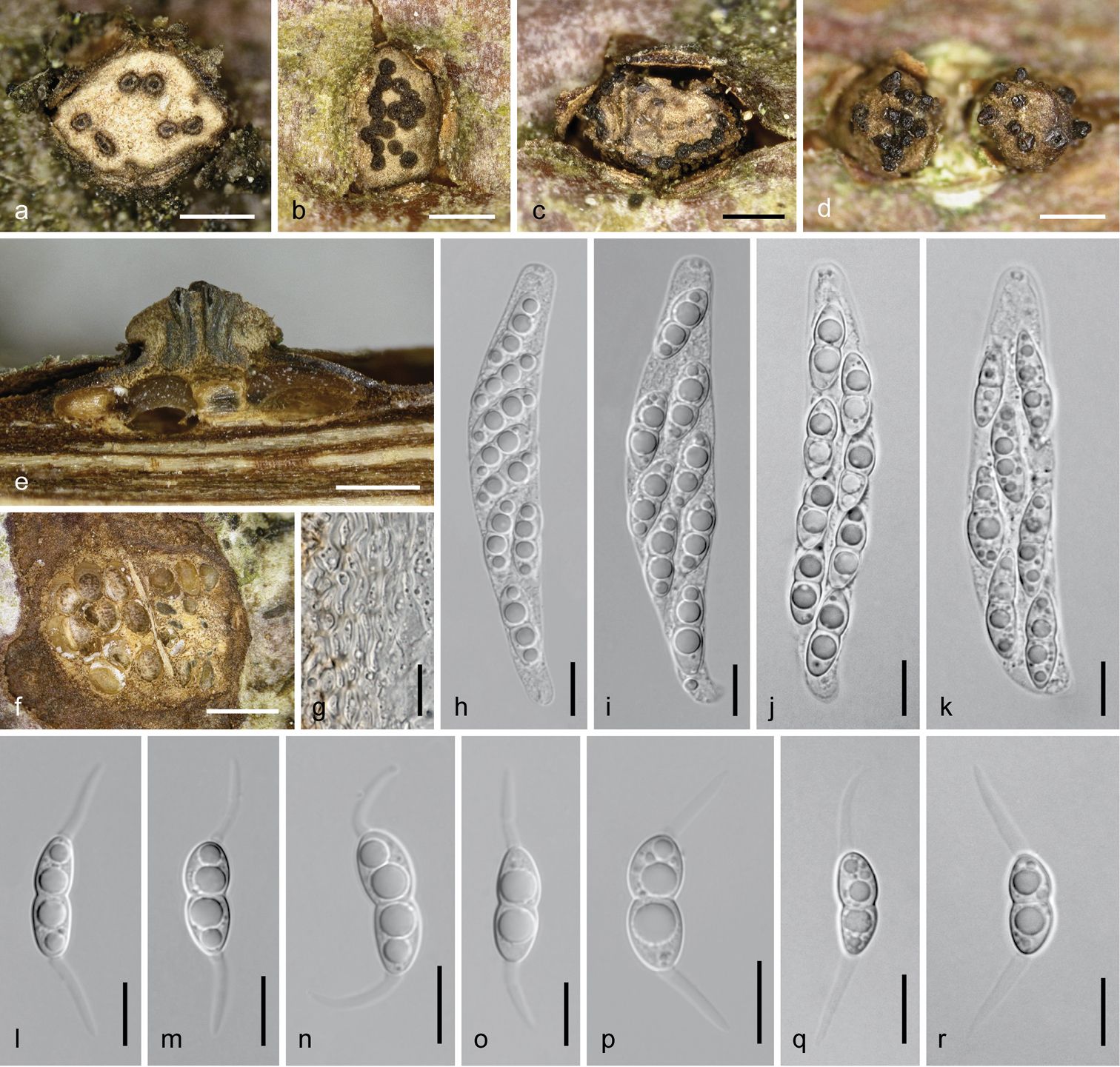 Imágenes correspondientes al proceso de identificación del  &quot;Dendrostoma atlanticum&quot;.