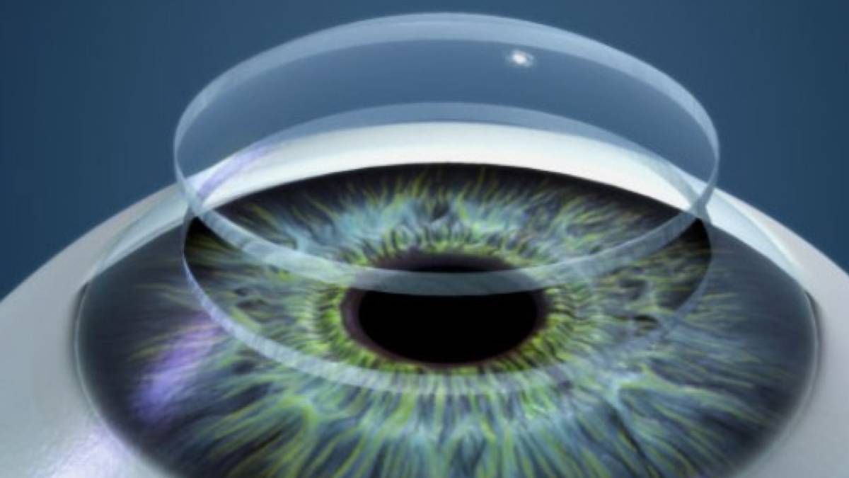 Una cornea sintética ayuda a un hombre a recuperar la visión