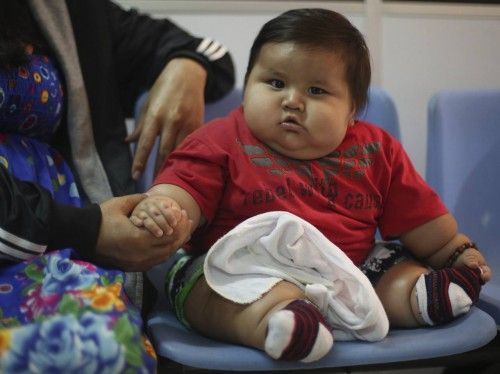 An eight-month-old child sits at a clinic for the obese in Bogota