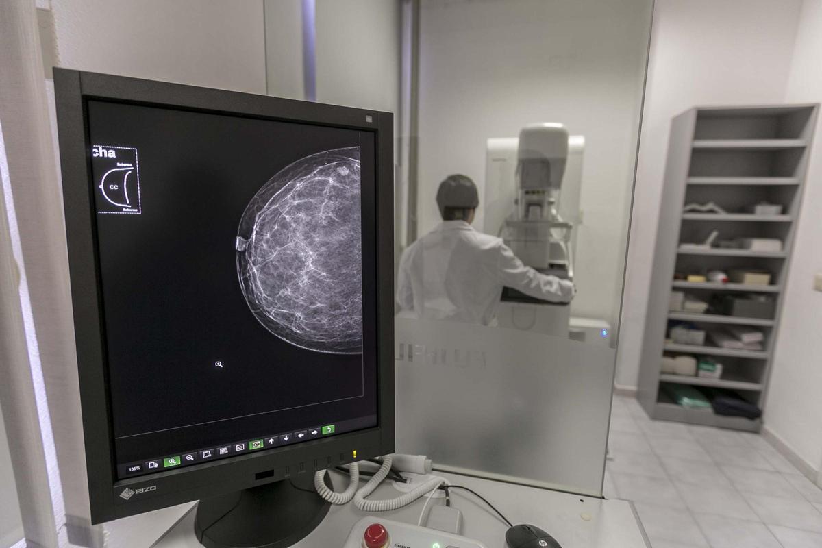 Una mamografía a una paciente en un centro de salud de Elche