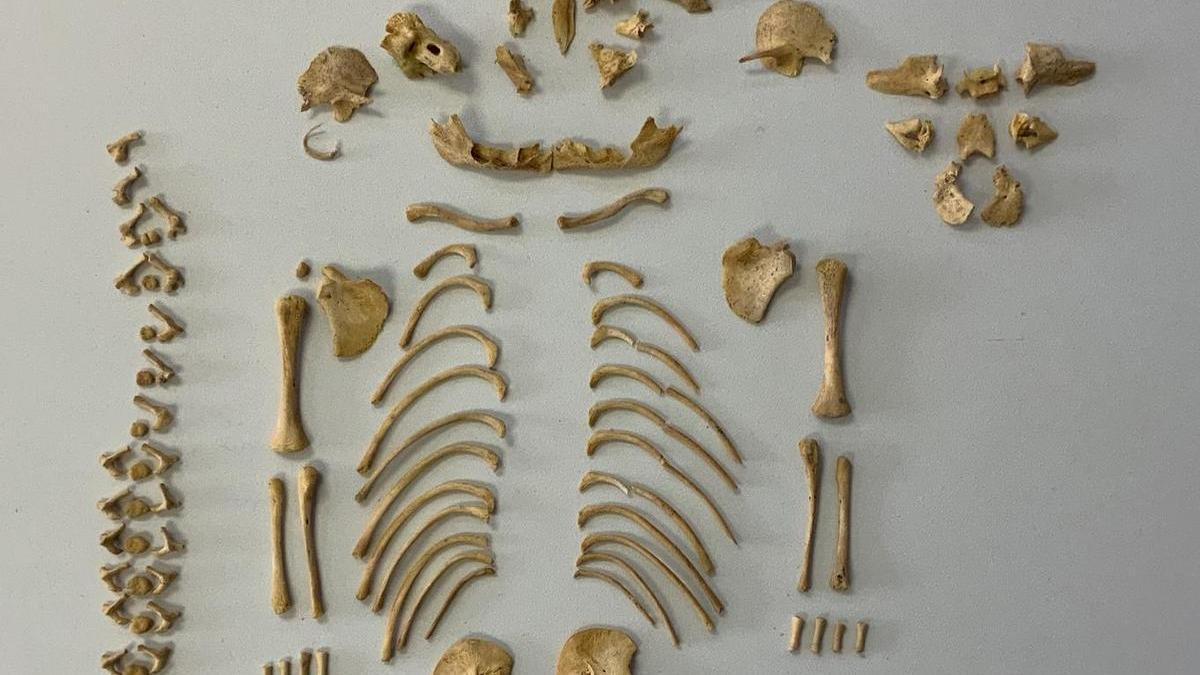 Esquelet de nena amb síndrome de Down que va morir al voltant de les 28 setmanes d'edat gestacional, descobert en un jaciment de l'edat del ferro de Navarra