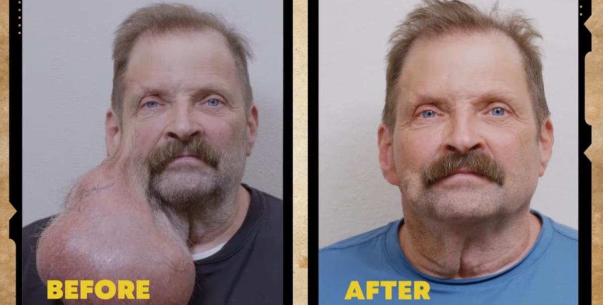 El antes y el después de la operación