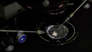 zentauroepp46033190 in this oct  9  2018 photo  an embryo receives a small dose 191021172634