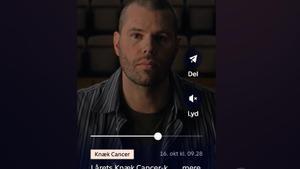 Mikkel Hansen, después de raparse la cabeza para visibilizar la lucha contra el cáncer