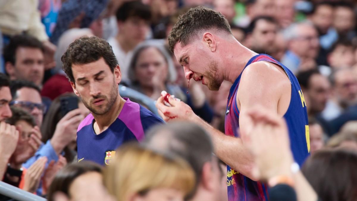 Joel Parra ended up with a bloody nose in the match against Olympiacos