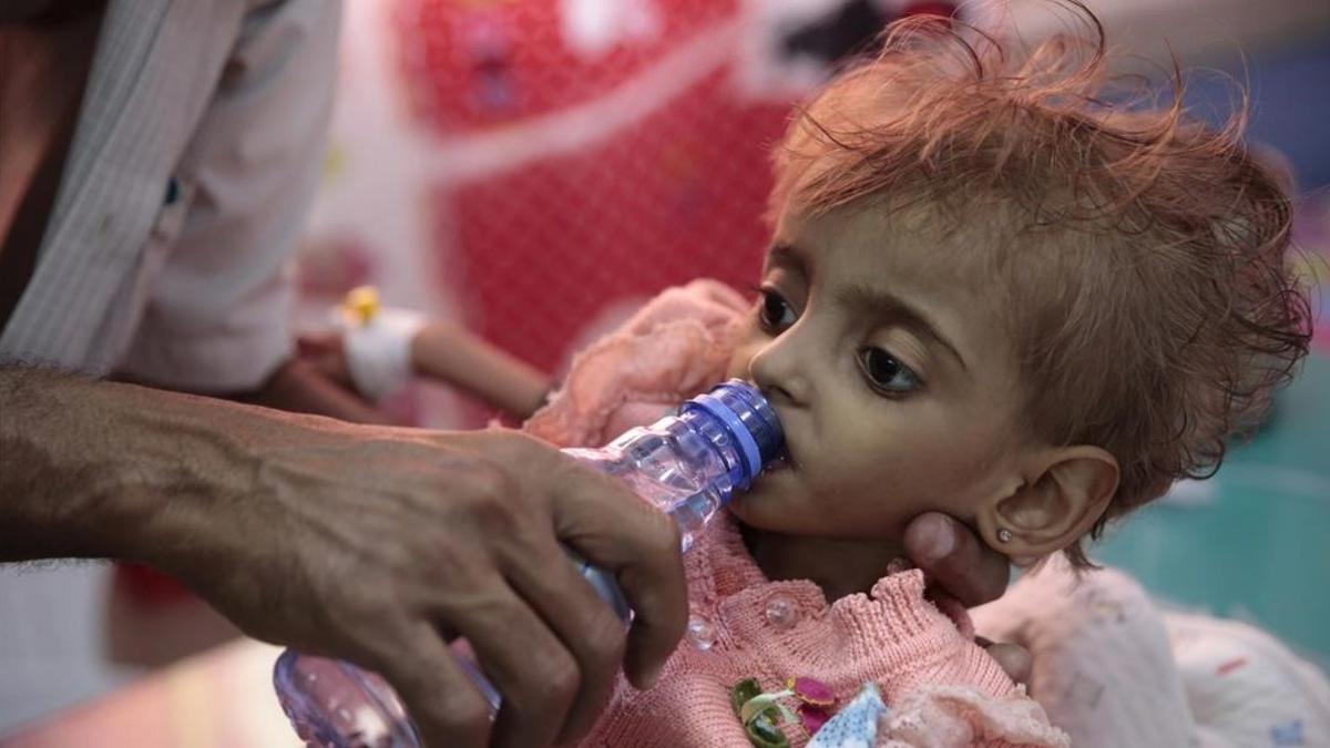 Una niña malnutrida en el hospital de Al Hudeida.