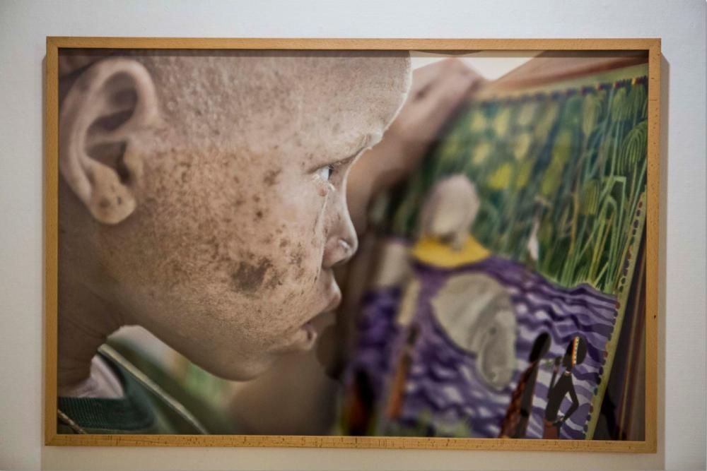 Imagen de la exposición "Albino"