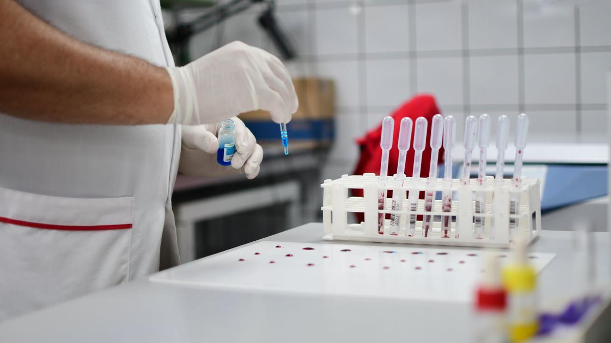 El SES destina 47,5 millones a los reactivos de las analíticas en Extremadura