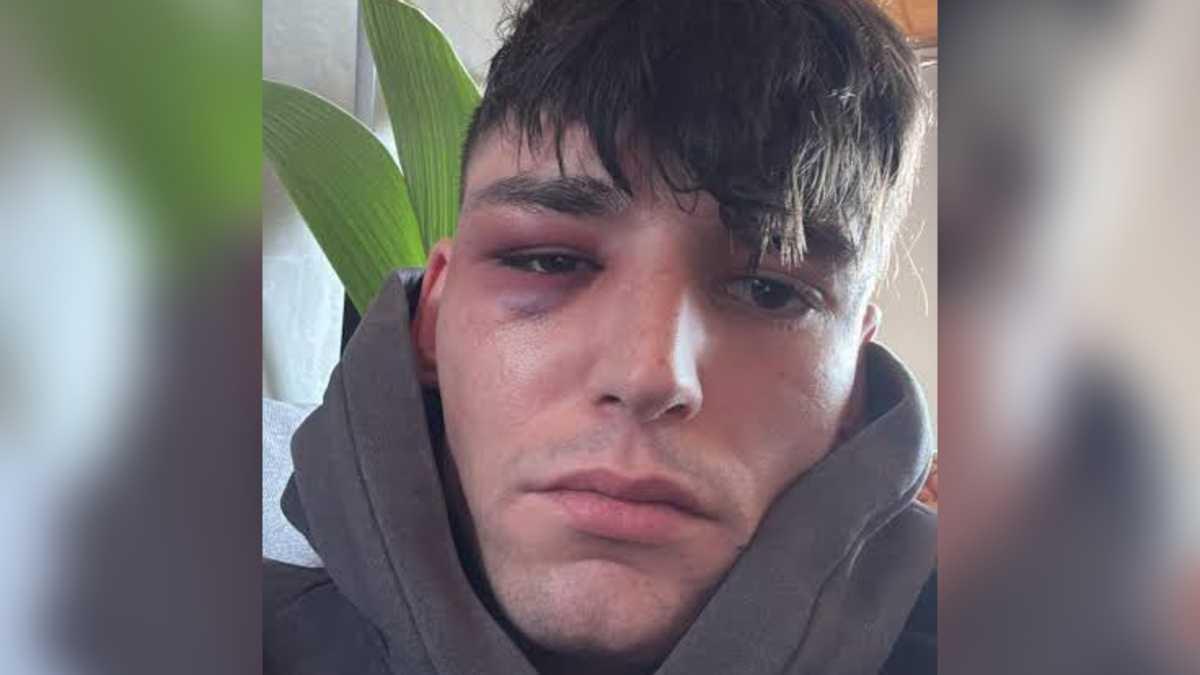 Pascal Kaiser, després de l'agressió homòfoba.