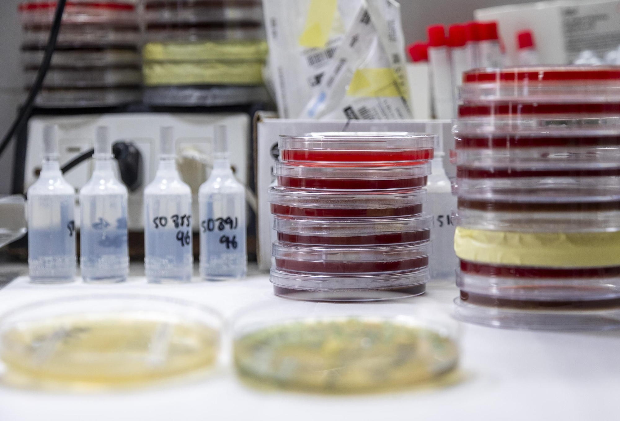 Protocolo para optimizar la respuesta rápida en código sepsis en Alicante