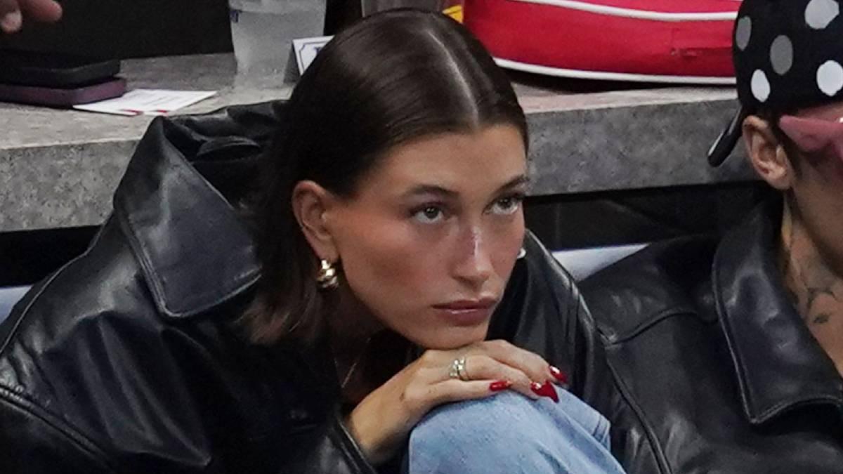 Hailey Bieber se pronuncia en redes por un brote muy grave de dermatitis