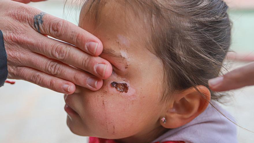 Denuncian la caída de una niña de 4 años en La Matanza por el mal estado del parque