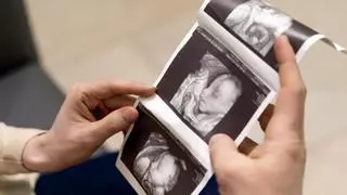 UGT denuncia que unas 200 embarazadas se quedaron sin ecografía por falta de personal