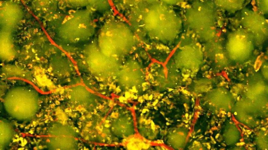 Un biomaterial inyectable activa el sistema inmunológico para reparar el cerebro tras un accidente cerebrovascular