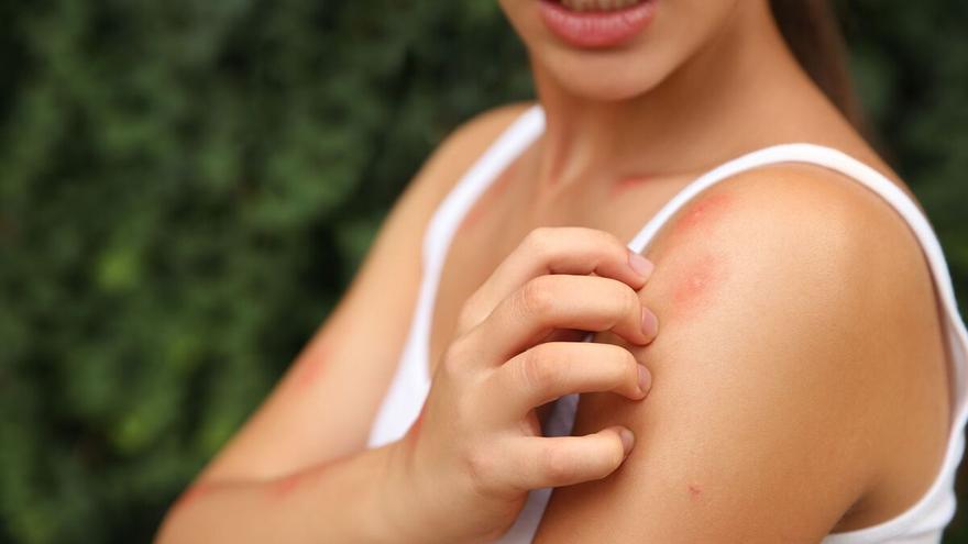 Cómo usar bien el repelente de mosquitos para que nos proteja y no provoque reacciones