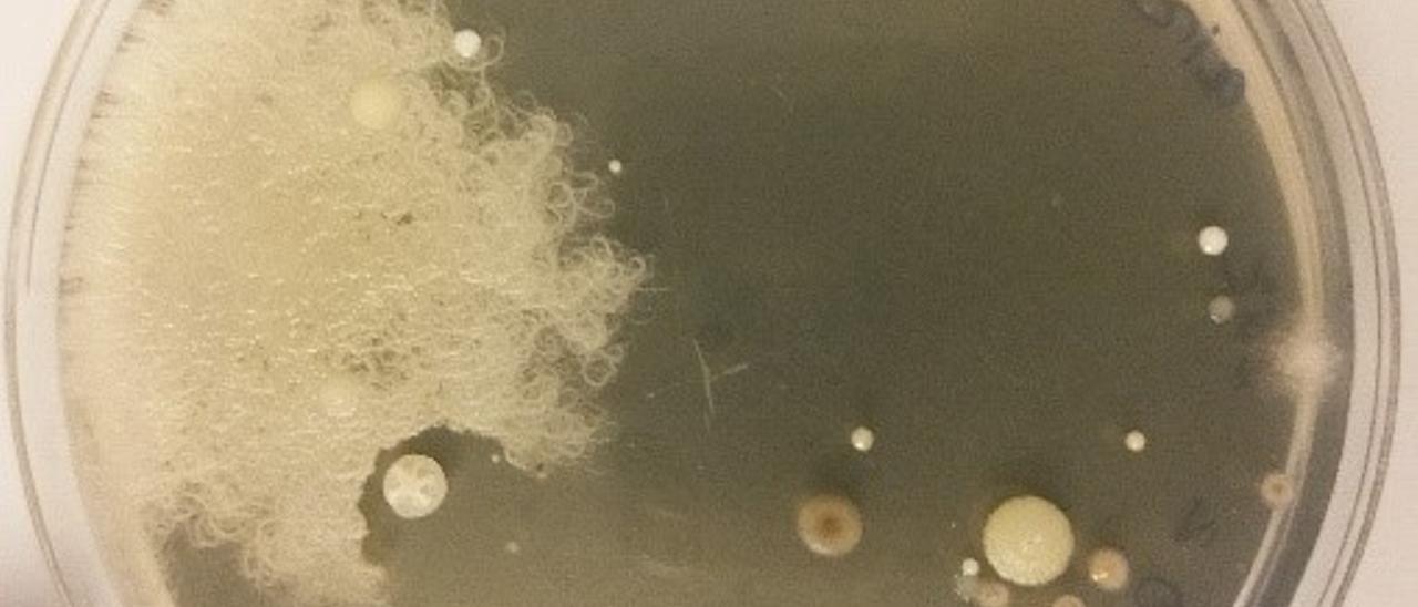 Colonias de bacterias obtidas de solo. Pódese observar que a colonia estrelada inhibe o crecemento da colonia filiforme