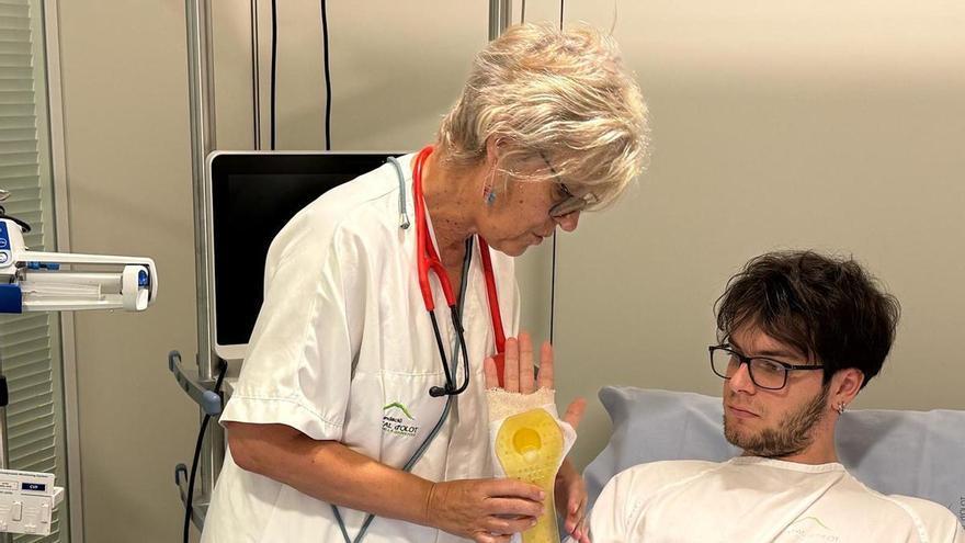 Tres hospitals gironins proven amb èxit fèrules impreses amb 3D per a fractures de canell que poden substituir el guix