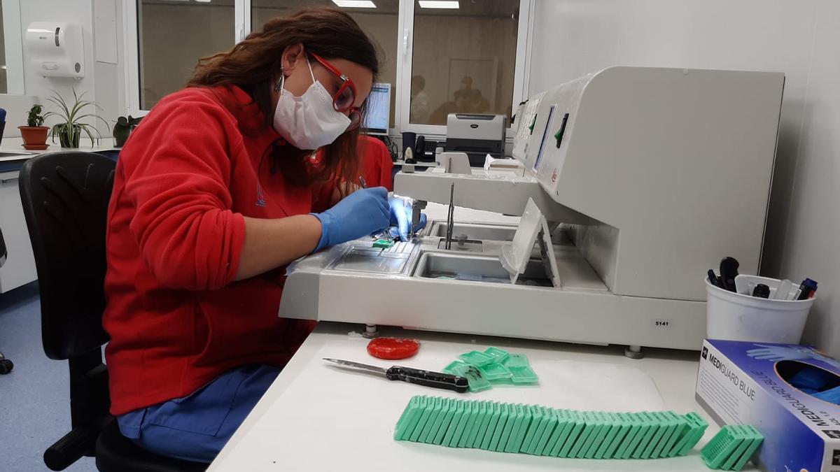 Una trabajadora en el Laboratorio de Anatomía Patológica del Hospital de Elda.