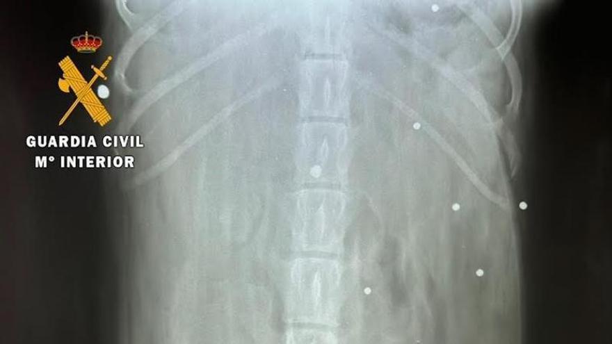 Radiografía con los impactos de escopeta recibidos por el can.