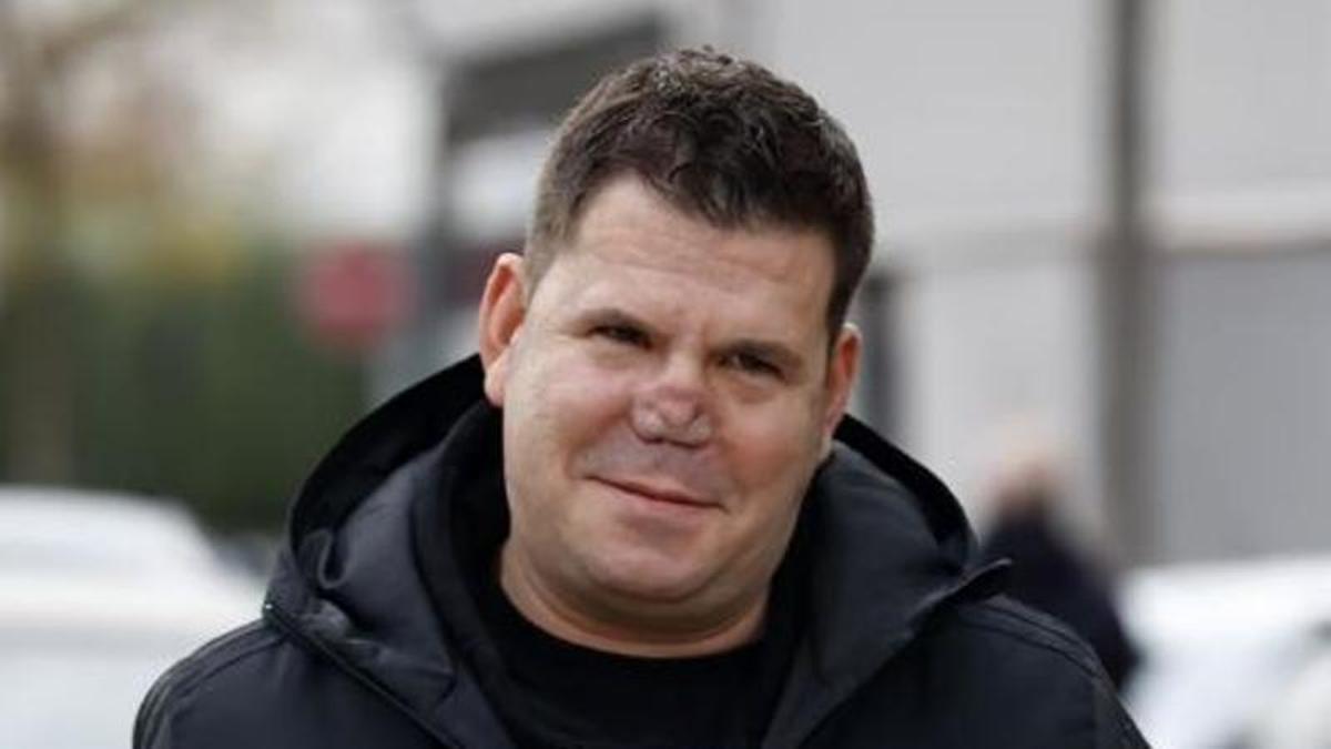 Lucas, de "Andy y Lucas", reaparece con nueva nariz tras su desastre estético: "Me han puesto una escayola"