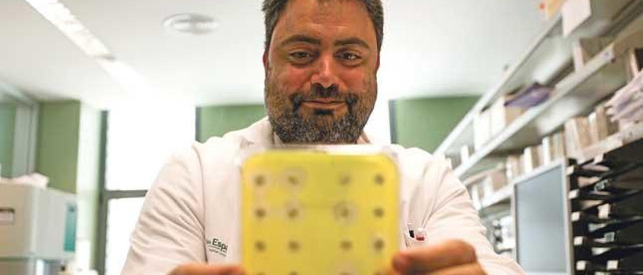 El microbiólogo Antonio Oliver observando unas muestras de agentes infecciosos en los laboratorios de Son Espases.