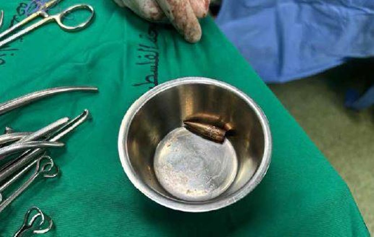 “Imagen 90: Bala israelí encontrada en el cuerpo de Abdul Rahman, de 16 años, tras ser extraída por los cirujanos. Presentaba heridas de bala en tórax y abdomen. Abdul Rahman fue atacado mientras esperaba recibir comida del centro de distribución de comida que los israelíes, junto con una compañía estadounidense, han habilitado en Rafah. (Jan Yunis, 3 de junio de 2025)”.