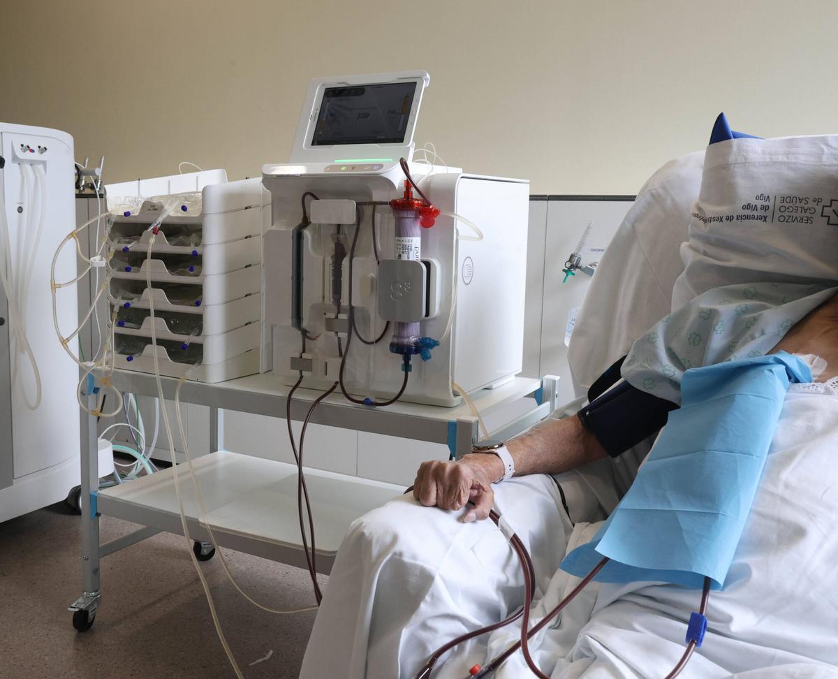 Sala de entrenamiento del hospital Álvaro Cunqueiro con la máquina de diálisis a domicilio.
