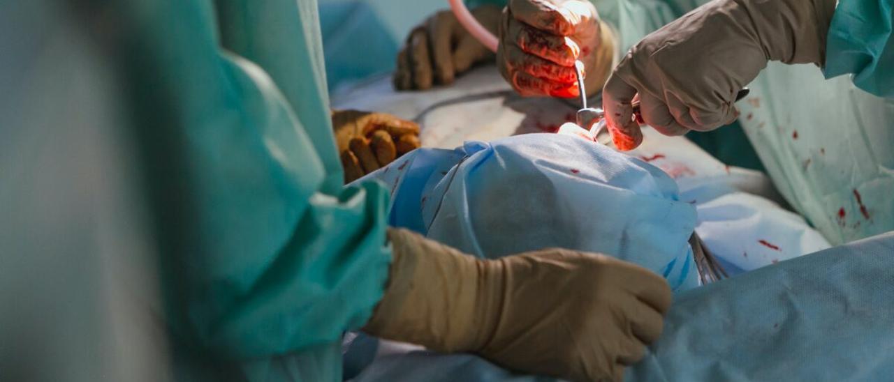 Varios cirujanos realizan un trasplante, en una imagen de archivo.