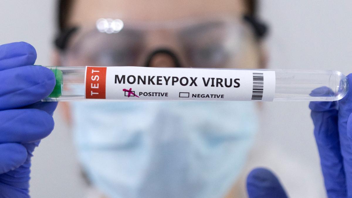Una profesional sanitaria muestra un test positivo del virus de la viruela del mono.