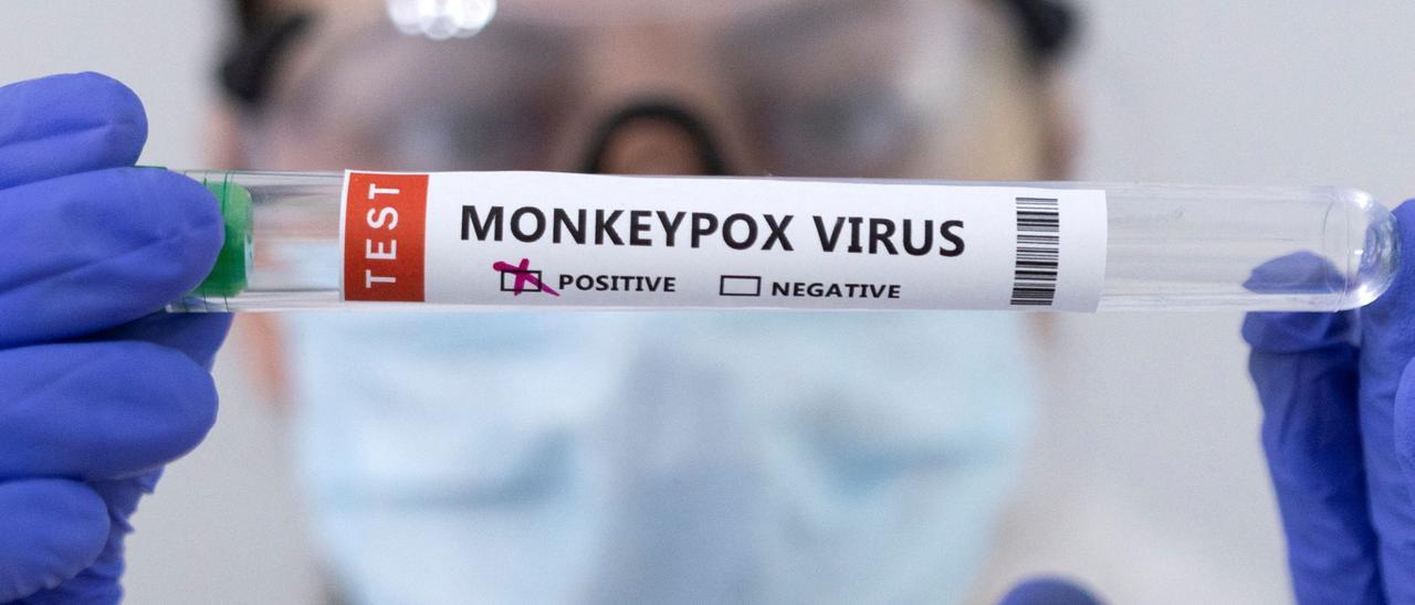 Una profesional sanitaria muestra un test positivo del virus de la viruela del mono.