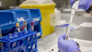 La ciencia culmina el mapa de biomarcadores que permite la detección precoz de ELA, alzhéimer y otras enfermedades neurodegenerativas