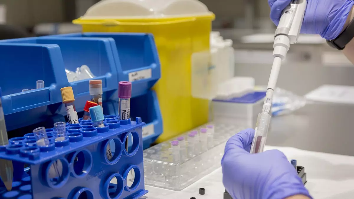 La ciencia culmina el mapa de biomarcadores que permite la detección precoz de ELA, alzhéimer y otras enfermedades neurodegenerativas