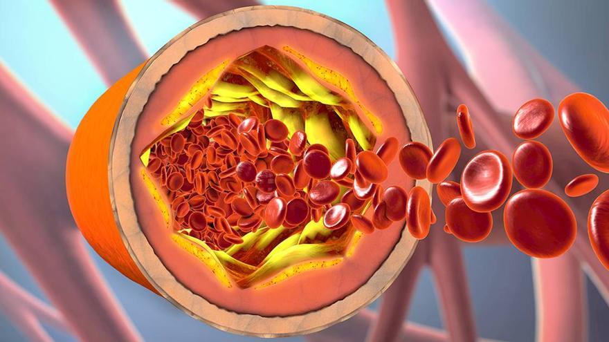 El colesterol &quot;malo&quot; dificulta la circulación.
