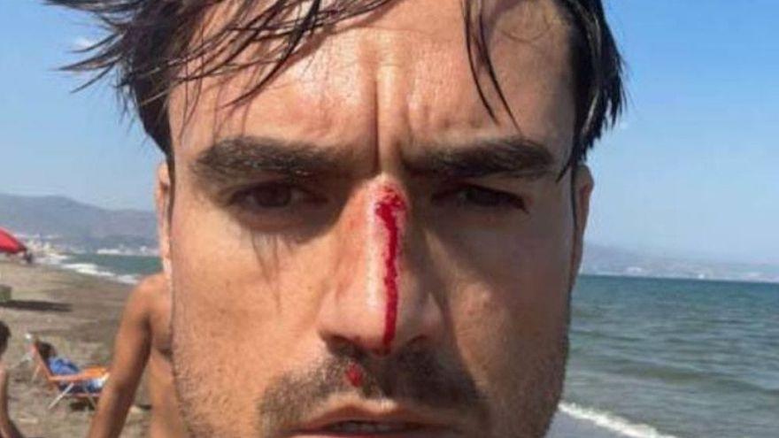 Víctima de agresión homófoba en una playa de Málaga: &quot;Sin las imágenes que grabé de mi agresor no podría haberle denunciado&quot;