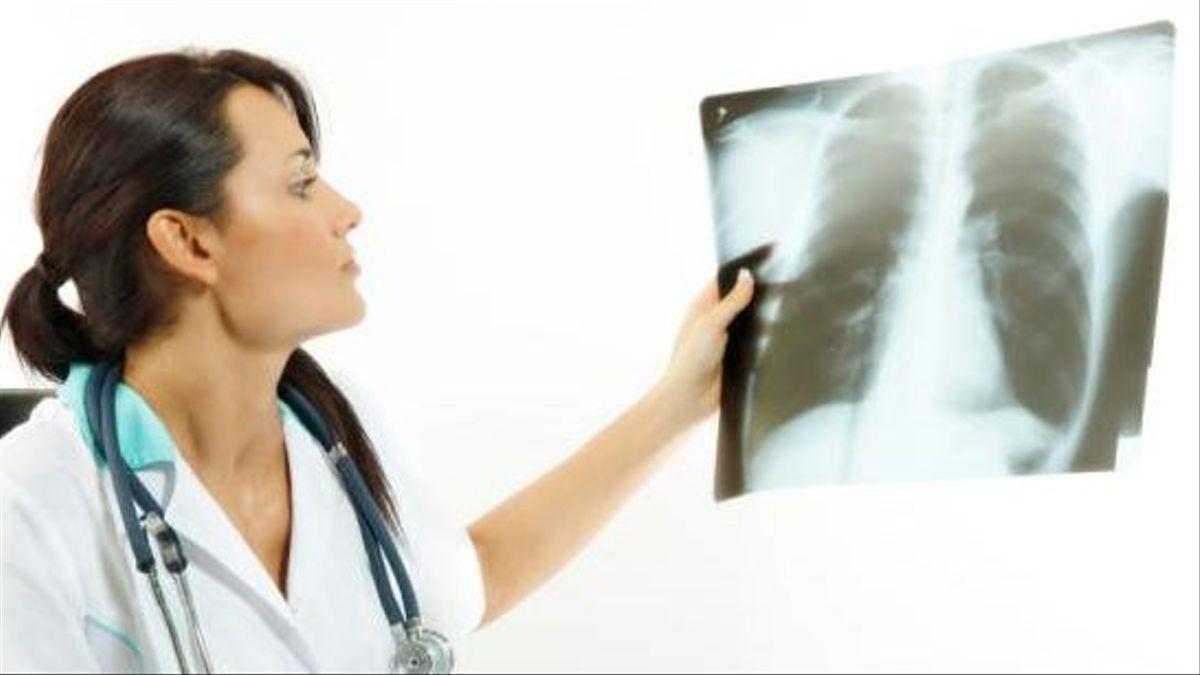 Una doctora mira una radiografia