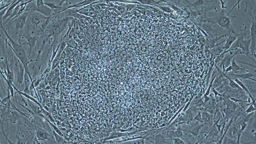 La ciencia consigue células madre humanas a partir de una clonación