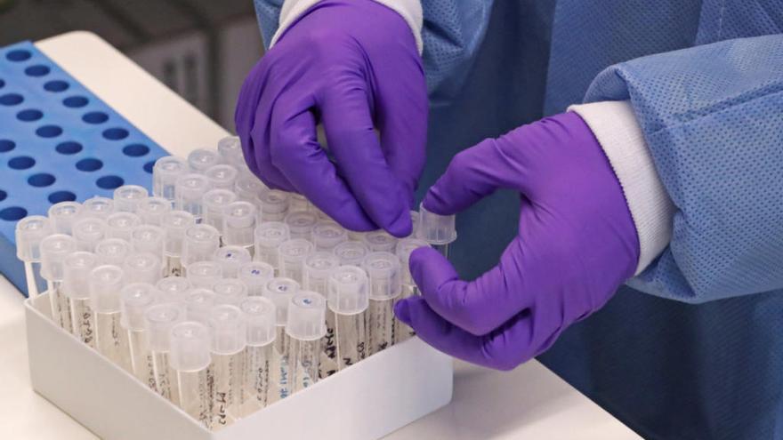 Expertos en Medicina Preventiva piden más test diagnósticos de coronavirus