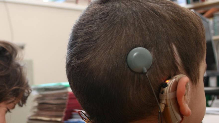 El Hospital Clínico ha ayudado a más de 580 personas sordas a oír con implantes cocleares