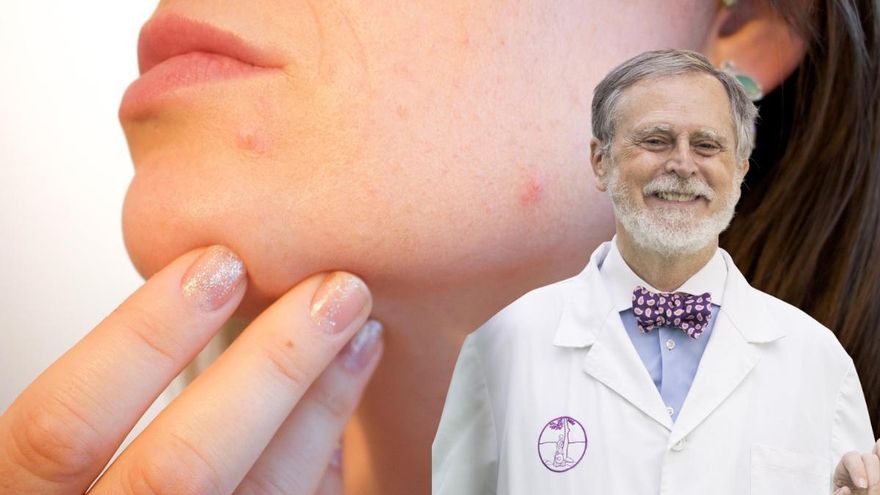 Jerónimo Ors, farmacéutico: &quot;El sol y el calor pueden provocar el temido acné de Mallorca en tu piel&quot;