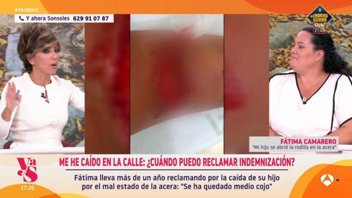 La lucha de una madre para que indemnicen a su hijo tras sufrir un accidente: "Llevo más de un año así"