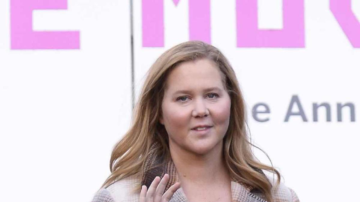 Amy Schumer, antes de retirarse los implantes en las mejillas