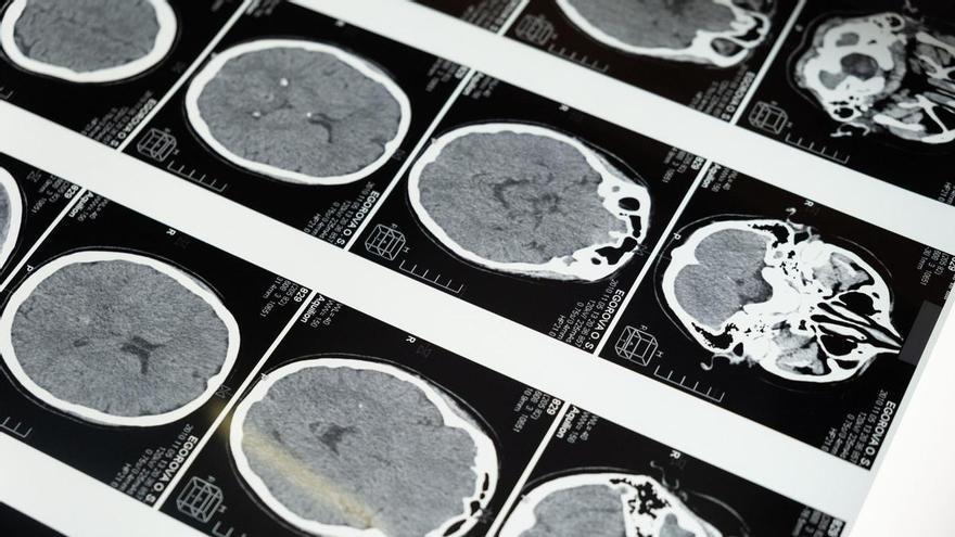 Com “escolta” la medicina l’activitat del cervell