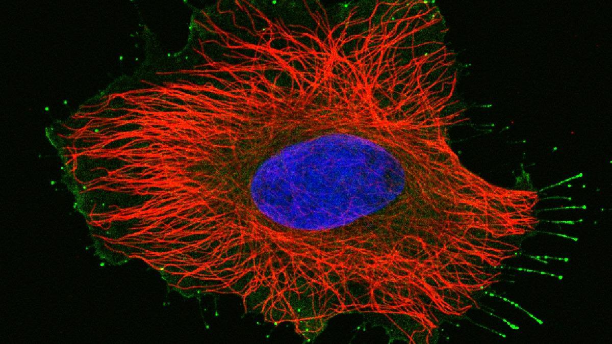 Los microtúbulos (rojos) forman el &quot;esqueleto&quot; de las neuronas.